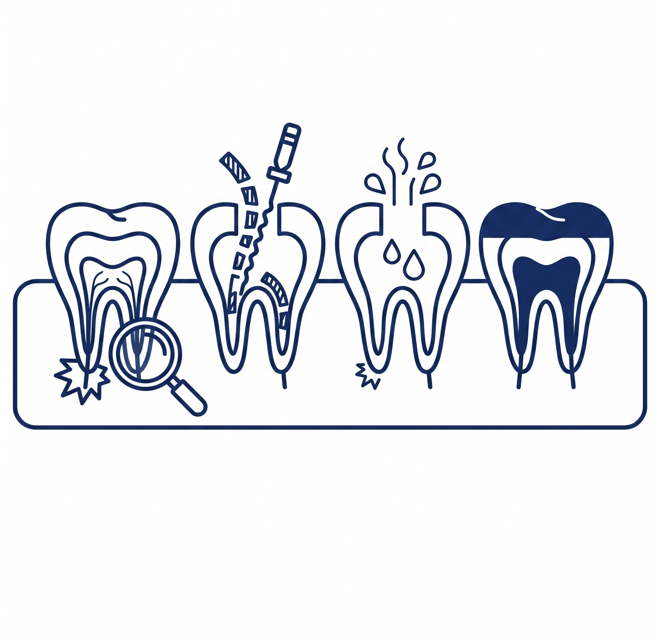 Endodontic Retreatment